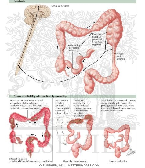 Pathophysiology of the Colon