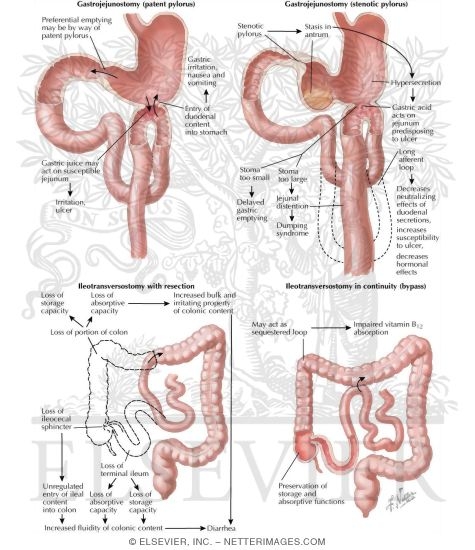 Physiology of Gastro-Enteric Stomas