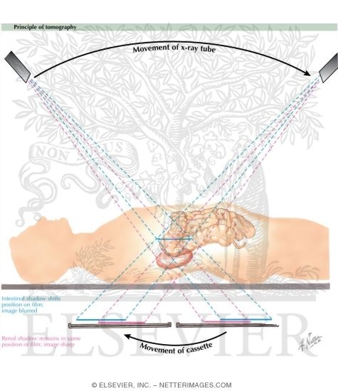 Watermarked preview of labeled image: Principle of Tomography