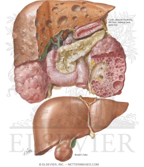 Watermarked preview of labeled image: Congenital Anomalies - Liver