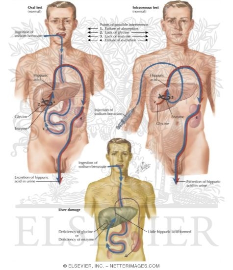 Watermarked preview of labeled image: Detoxification: Hippuric Acid Formation