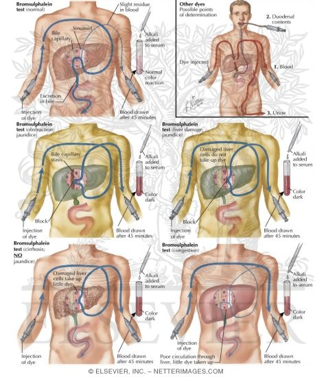 Watermarked preview of labeled image: Dye Excretion Test