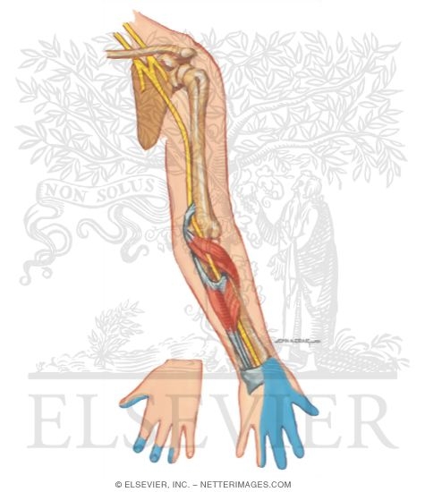 Common Sites of Upper Extremity Nerve Entrapment