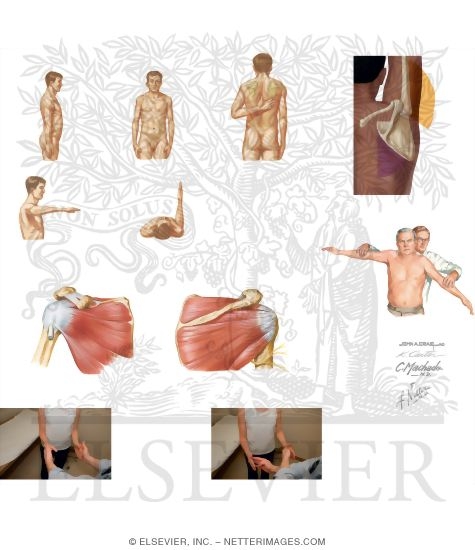 Watermarked preview of unlabeled image: Physical Examination of Shoulder