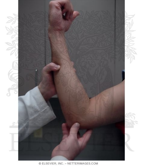 Medial Epicondyle Palpation