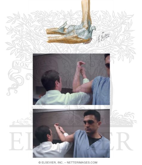 Watermarked preview of unlabeled image: Ulnar Collateral Ligament Sprain