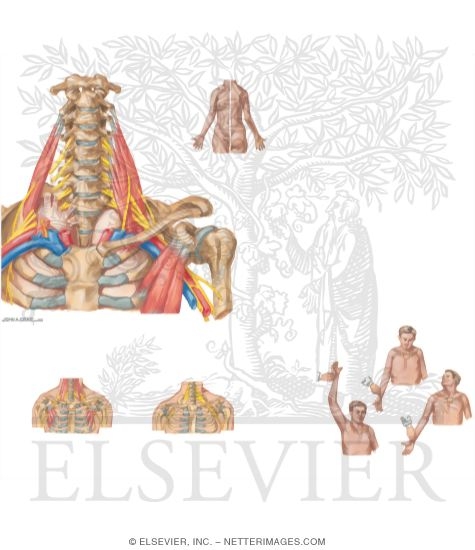 Watermarked preview of unlabeled image: Thoracic Outlet Syndrome