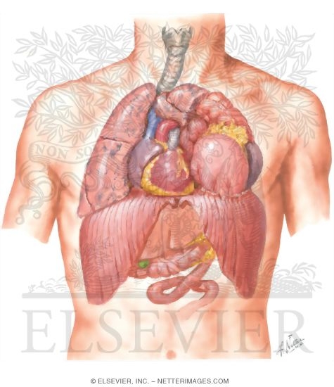 Rupture of Diaphragm
