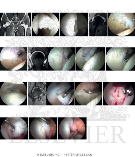 Watermarked preview of unlabeled image: Intra-articular Disorders