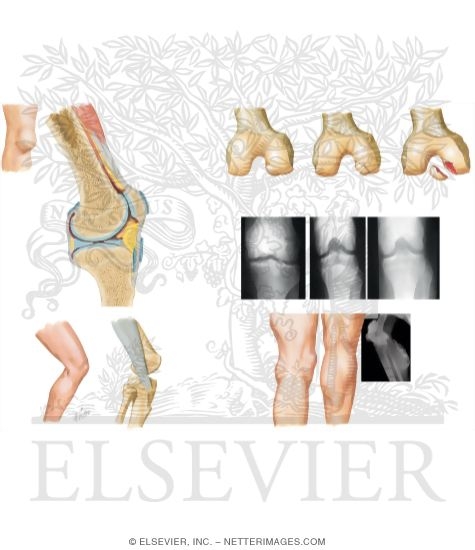 Watermarked preview of unlabeled image: Miscellaneous Knee Conditions