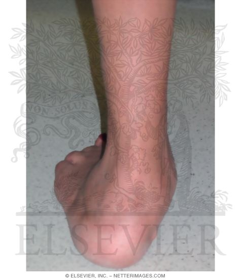 Too Many Toes Test