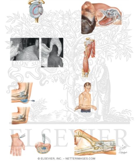 Watermarked preview of unlabeled image: Upper Extremity Injections