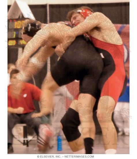 Watermarked preview of unlabeled image: Back Injuries