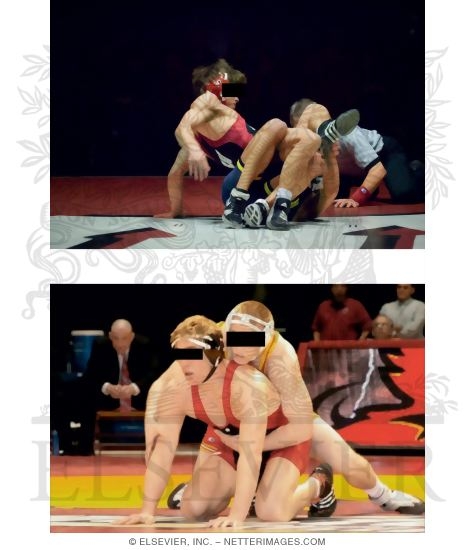 Watermarked preview of unlabeled image: Elbow Injuries