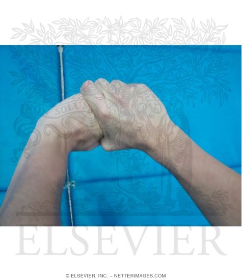 Watermarked preview of unlabeled image: Wrist Injuries In Diving