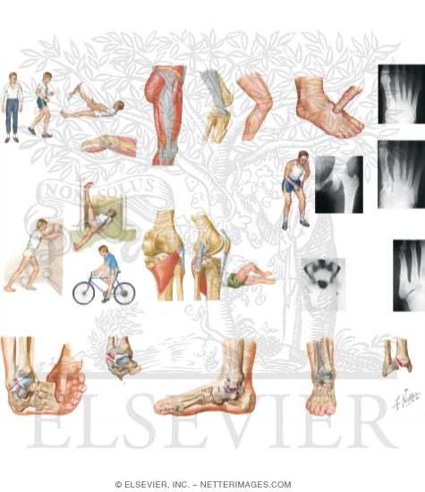 Watermarked preview of unlabeled image: Lower Extremity Injuries