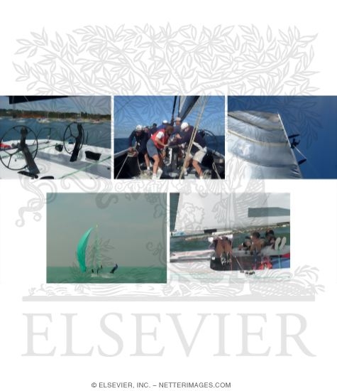 Watermarked preview of unlabeled image: Crew Positions and Specific Injury Examples In Sailing
