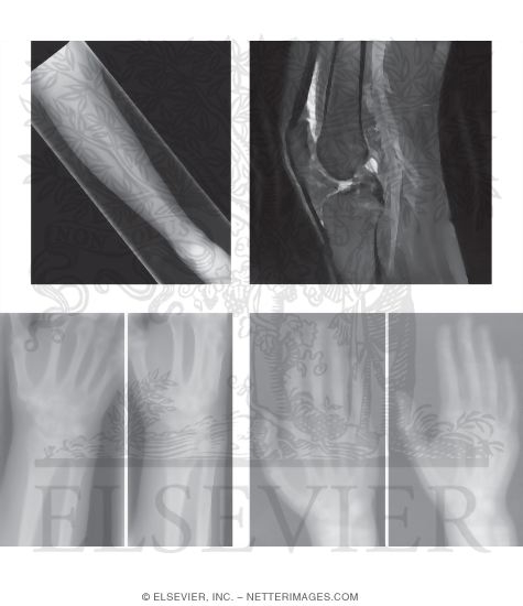 Watermarked preview of unlabeled image: Common Injuries In Field Hockey