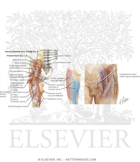 Watermarked preview of labeled image: Nerve Entrapment