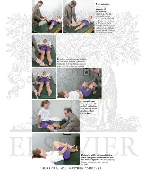 Watermarked preview of labeled image: Syndromes of the Pelvis, Hip, and Thigh