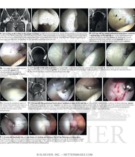 Watermarked preview of labeled image: Intra-articular Disorders