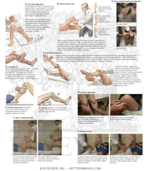 Watermarked preview of labeled image: Special Tests of the Knee