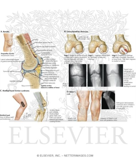 Watermarked preview of labeled image: Miscellaneous Knee Conditions