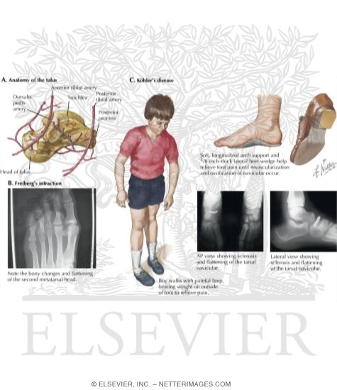 Watermarked preview of labeled image: Foot and Ankle Injuries and Problems