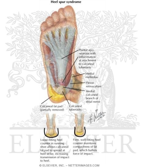 Plantar Fascia