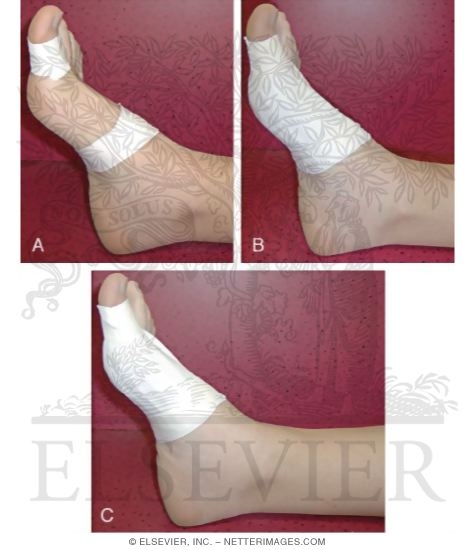 Watermarked preview of labeled image: Taping Procedures: Turf-Toe Taping
