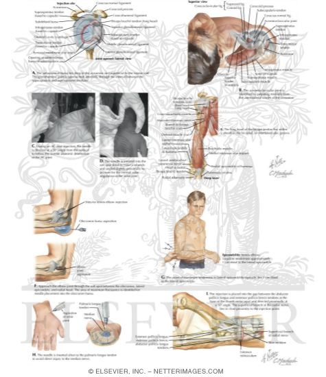Watermarked preview of labeled image: Upper Extremity Injections