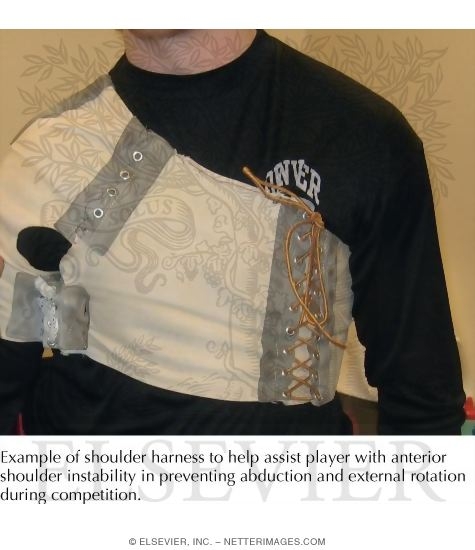 Watermarked preview of labeled image: Anterior Shoulder Instability