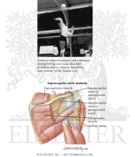 Watermarked preview of labeled image: Shoulder Injuries