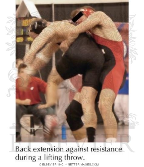 Watermarked preview of labeled image: Back Injuries