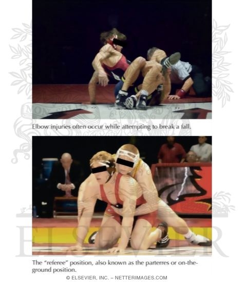 Watermarked preview of labeled image: Elbow Injuries