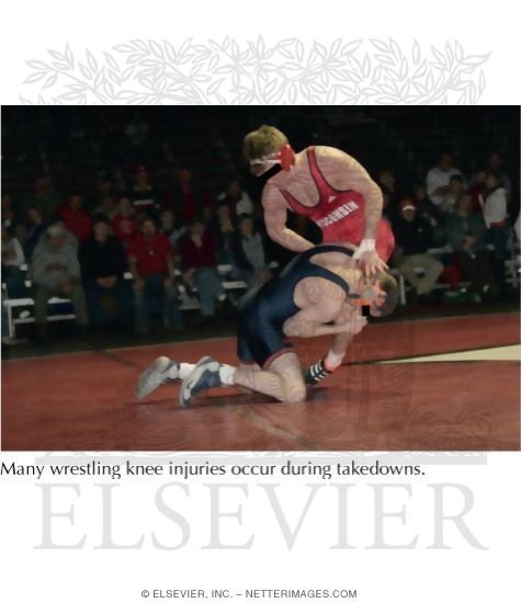 Watermarked preview of labeled image: Knee Injuries