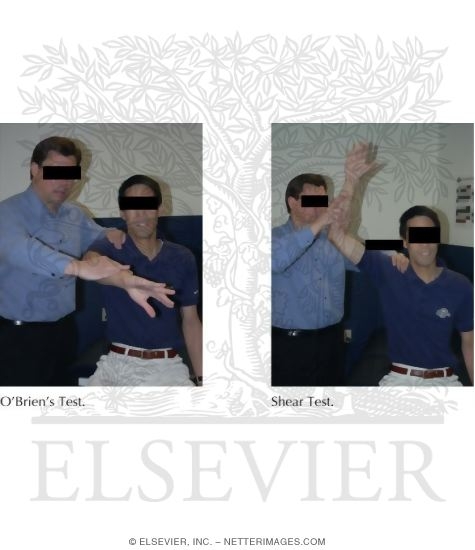 Watermarked preview of labeled image: Elbow Exam Tests