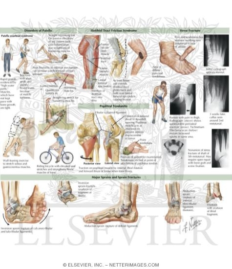 Watermarked preview of labeled image: Lower Extremity Injuries