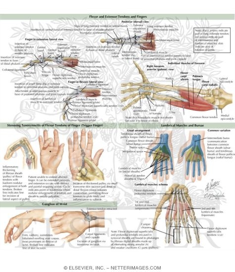 Watermarked preview of labeled image: Upper Extremity Climbing Injuries