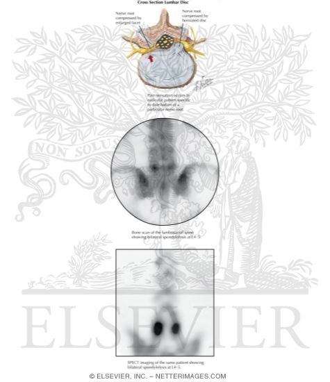 Watermarked preview of labeled image: Low Back Injuries In Rowing