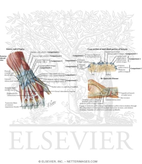 Watermarked preview of labeled image: Wrist and Forearm Injuries In Rowing