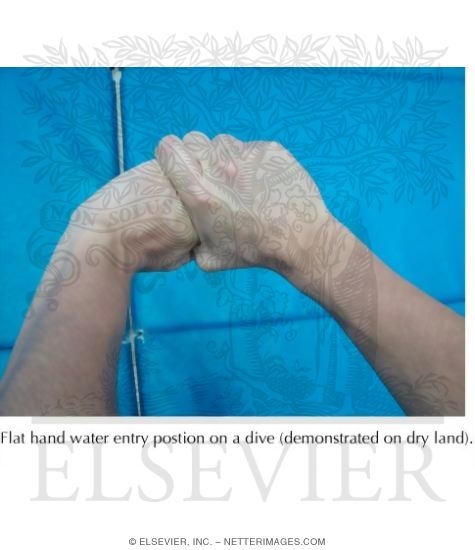 Watermarked preview of labeled image: Wrist Injuries In Diving