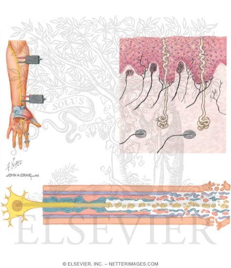Watermarked preview of unlabeled image: Nerve Conduction Studies