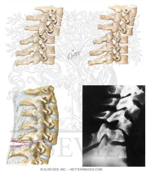 Watermarked preview of unlabeled image: Trauma of the Spine