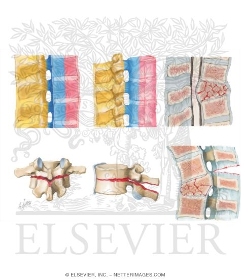 Watermarked preview of unlabeled image: Trauma of the Spine