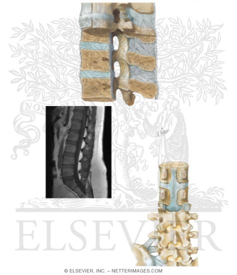 Watermarked preview of unlabeled image: Joints of the Spine