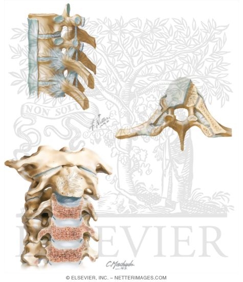 Watermarked preview of unlabeled image: Joints of the Spine