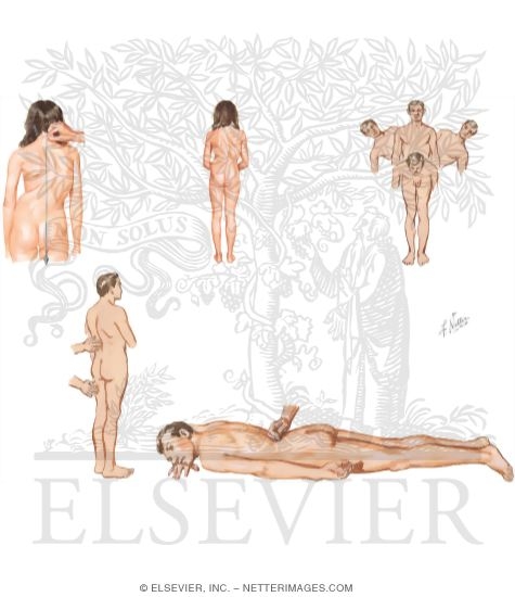 Watermarked preview of unlabeled image: Physical Examination of the Spine