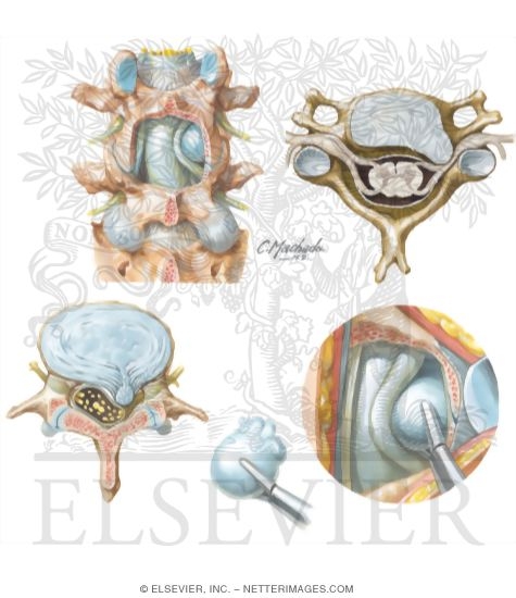 Watermarked preview of unlabeled image: Disorders of the Spine
