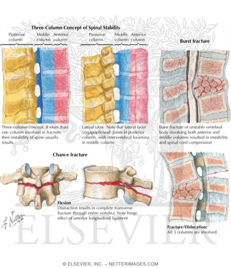 Watermarked preview of labeled image: Trauma of the Spine